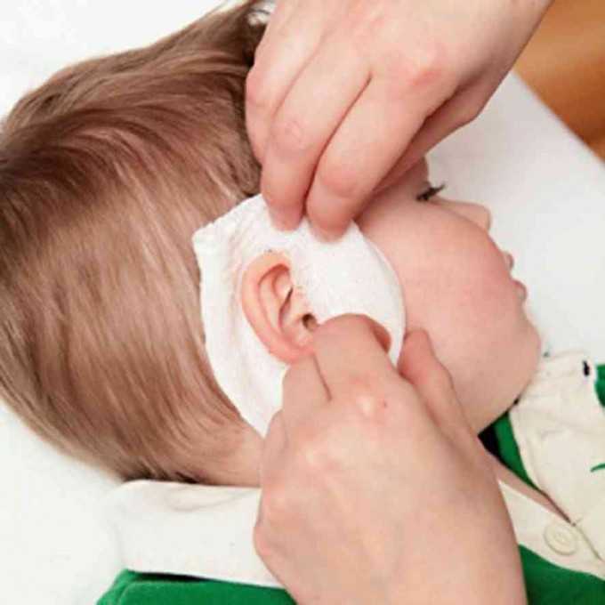 Как правильно чистить уши грудному ребенку от серы, и нужно ли это делать? как правильно чистить уши грудничкам до года и детям постарше от серы и других загрязнений