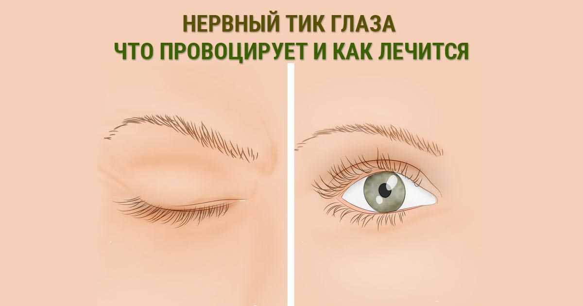 Лечение тиков у ребенка и навязчивых движений: как лечить моргание глазами