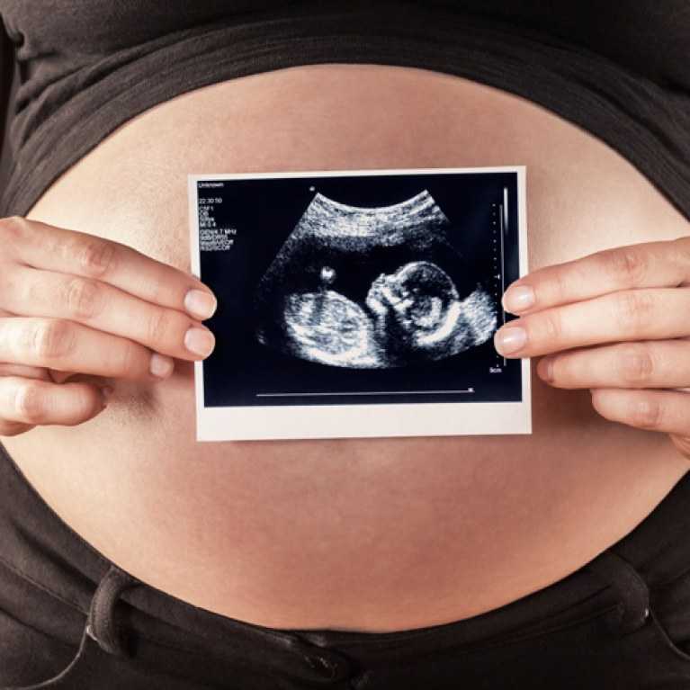 Узнайте все самое важное о 6 неделе беременности на нашем сайте ощущения женщины, признаки, симптомы, развитие плода