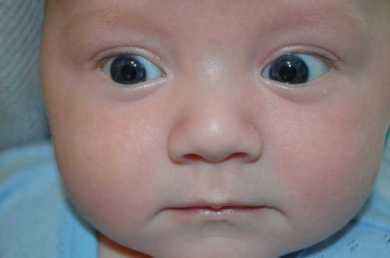 Когда меняется цвет глаз новорожденных и почему это происходит?