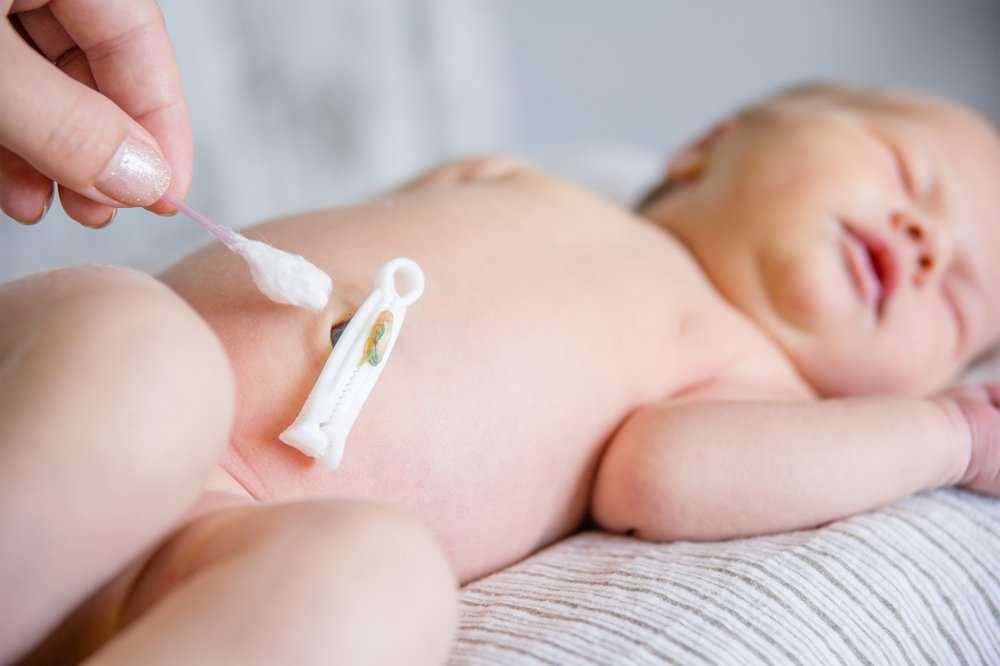 Обработка пупка у новорожденного: правила и процесс проведения | детские заболевания
как правильно обрабатывать пупок у новорожденных? | детские заболевания