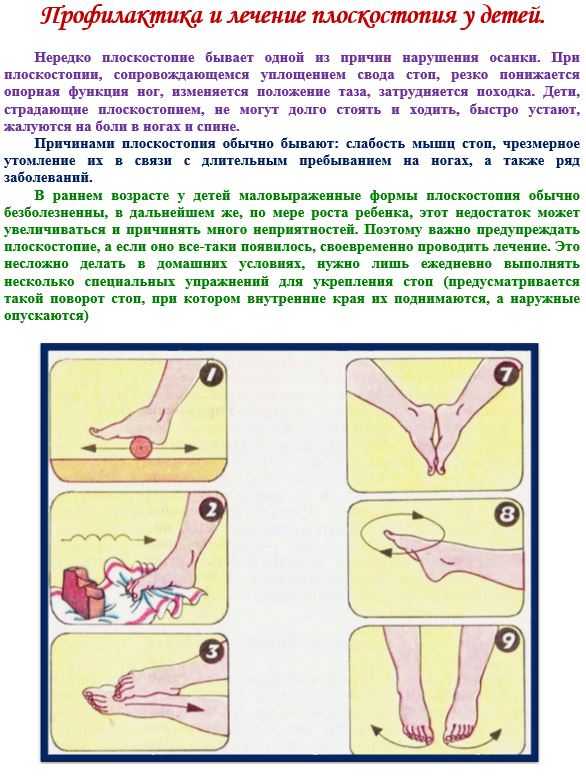 Массаж при плоскостопии у детей: как делать массаж стоп и ног в домашних условиях, массажер для профилактики