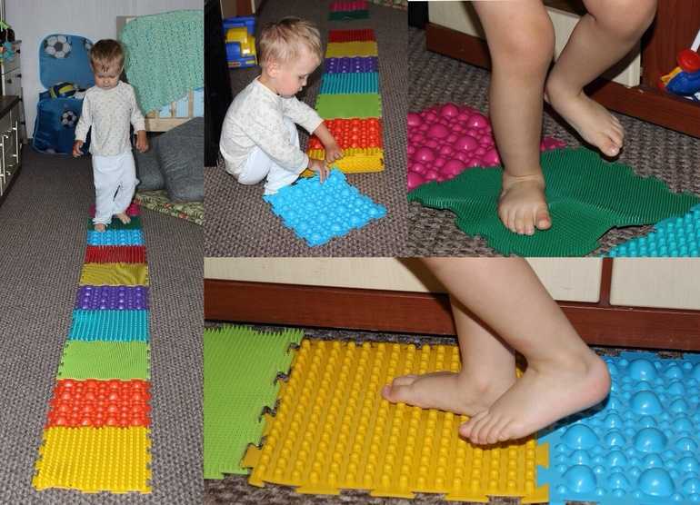 Эффективность ортопедических массажных ковриков для лечения плоскостопия у детей