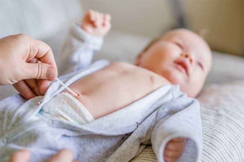 Гноится пупок у новорожденного ребенка: причины, что делать, методы лечения, возможные последствия