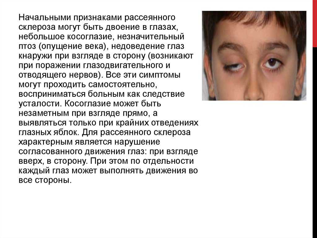 Причины и лечение нервного тика глаза у детей