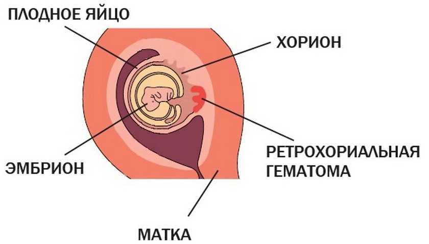 Что показывает узи у беременных двойней. основные причины рождения двойни