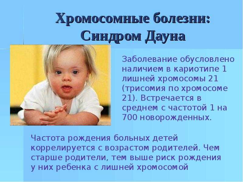 Ребенок с синдромом дауна (59 фото): признаки, какой получают уровень образования, причины у новорожденного, сколько живут и могут ли родиться здоровые дети