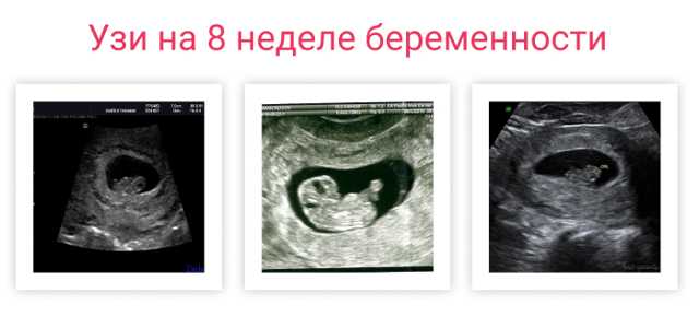 7 неделя беременности: что происходит, ощущения, размер и фото плода, фото узи и живота