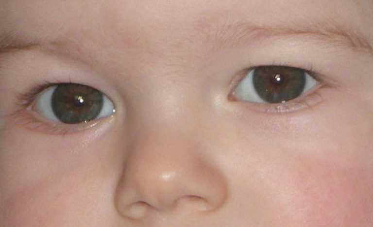Когда у детей меняется цвет глаз: младенцев, новорожденных и во сколько
