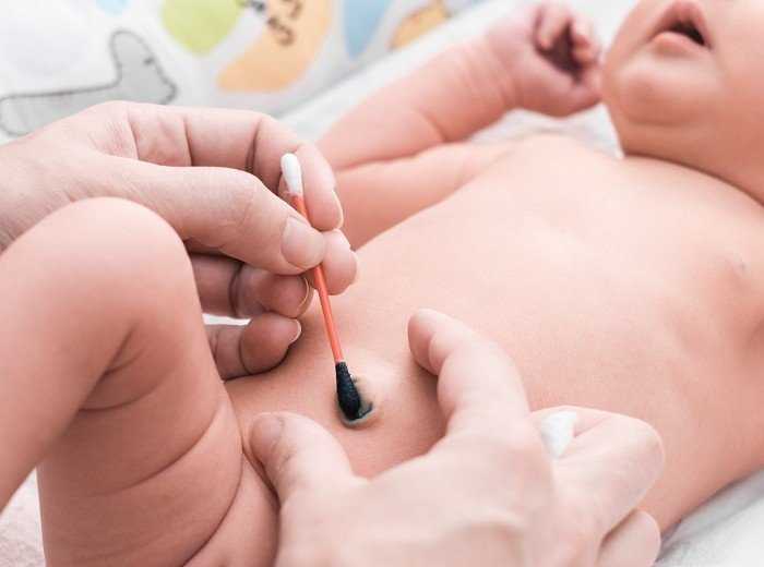 Уход за пупочной ранкой новорожденного: правильный алгоритм и чем мазать