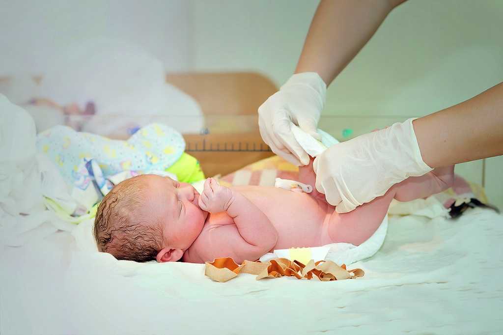 Как проводится уход за пупочной ранкой новорожденного