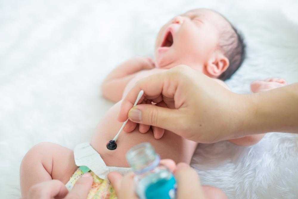 Как обрабатывать пупок новорожденному с прищепкой и без нее