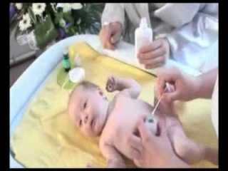 Мокнет пупок у новорожденного (лечение и профилактика)