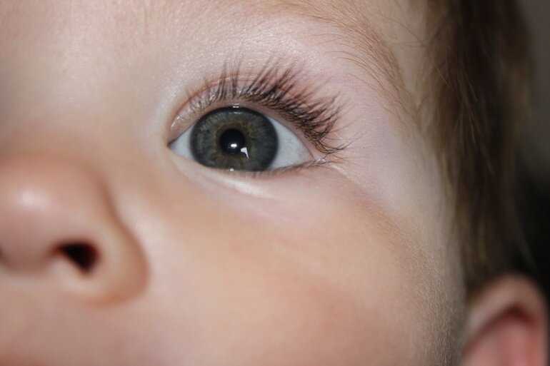 Когда меняется цвет глаз у новорожденных детей и как это происходит oculistic.ru
когда меняется цвет глаз у новорожденных детей и как это происходит