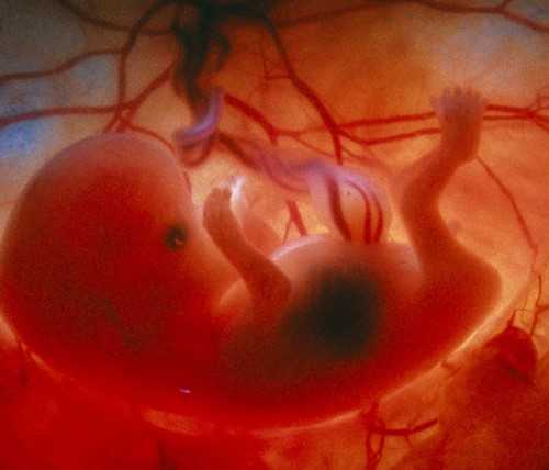 Узнайте все самое важное о 9й неделе беременности двойней на нашем сайте Что происходит в организме женщины, что видно на УЗИ, какие ощущения сопровождают беременную
