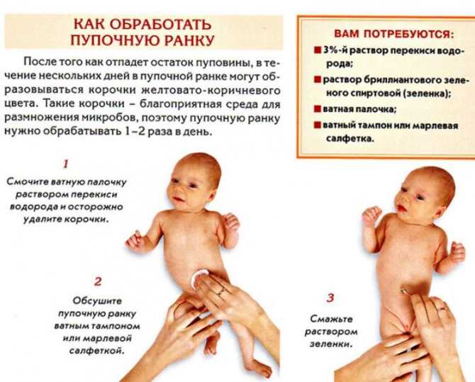 Обработка пупка новорождённого: используемые средства и правила проведения процедуры