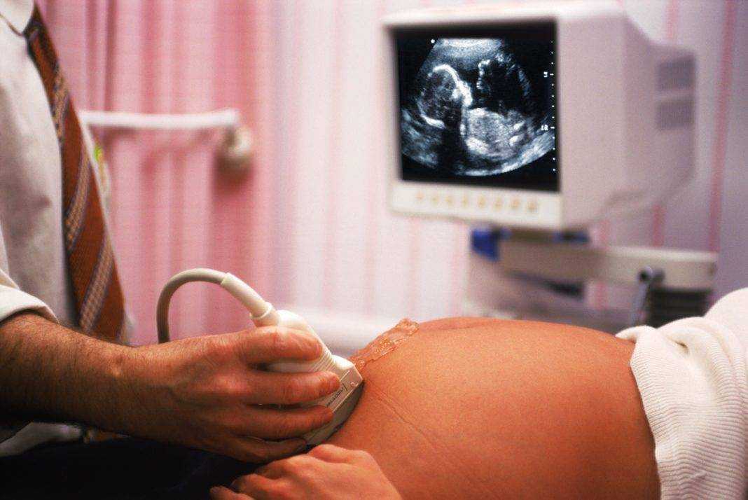 Узи на ранних сроках беременности (до 11 недель) в минске - 36и6