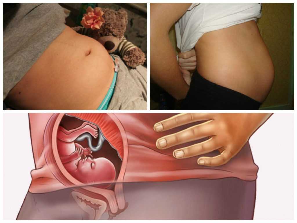 Срок беременности 19 недель — плод, ощущения, выделения, шевеления, узи, питание