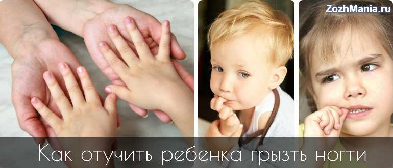 Как отучить ребенка грызть ногти Физиологические и психологические причины дурной привычки у малыша рекомендации психологов и народные средства по избавлению от проблемы