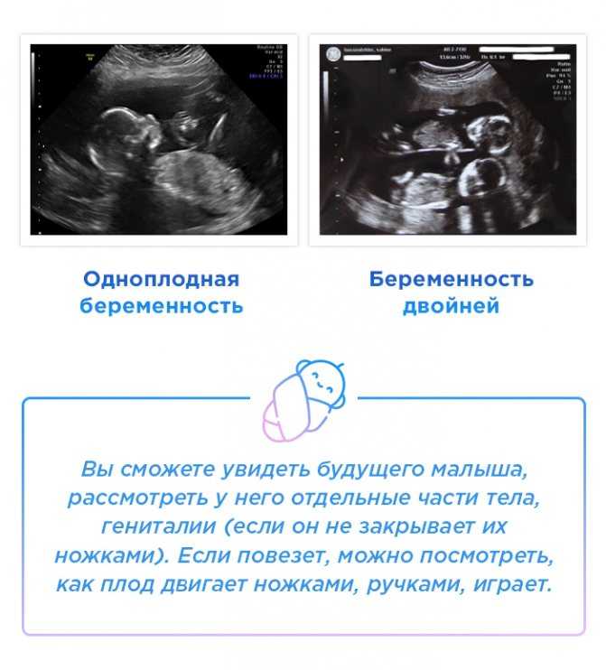 17 неделя беременности – что происходит, ощущения в животе на семнадцатой неделе беременности, развитие плода - agulife.ru