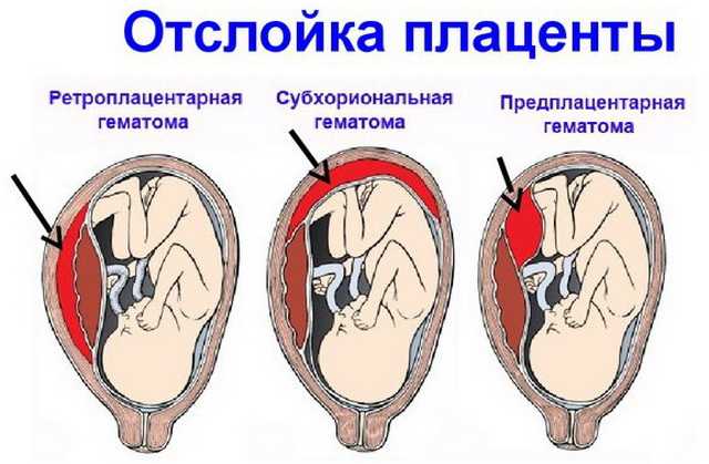 8 недель беременности – что происходит, развитие плода, ощущения, как выглядит живот - agulife.ru