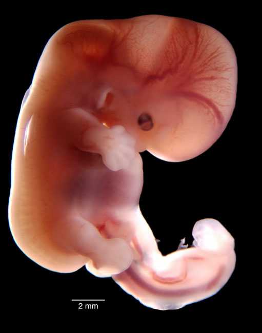 Как протекает беременность двойней | пологовий будинок «лелека»