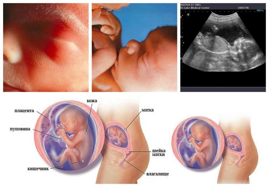 19 неделя беременности: что происходит с малышом и мамой | развитие и размер плода, ощущения женщины на 19 неделе беременности