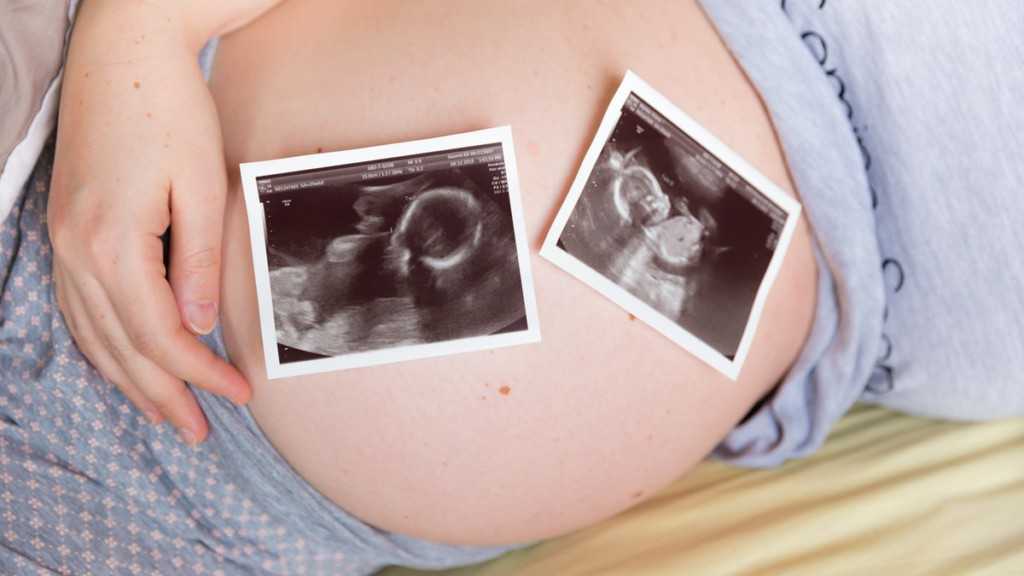 Чудо в животике: многоплодная беременность. – клиника «9 месяцев»