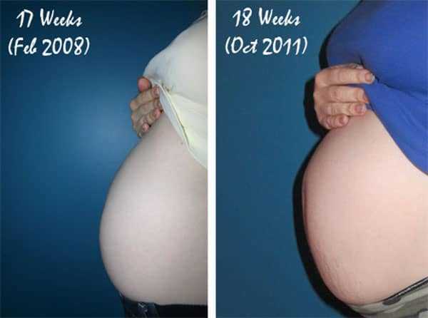 Первые шевеления и растущий животик: что происходит с малышом и мамой на 17-й неделе беременности