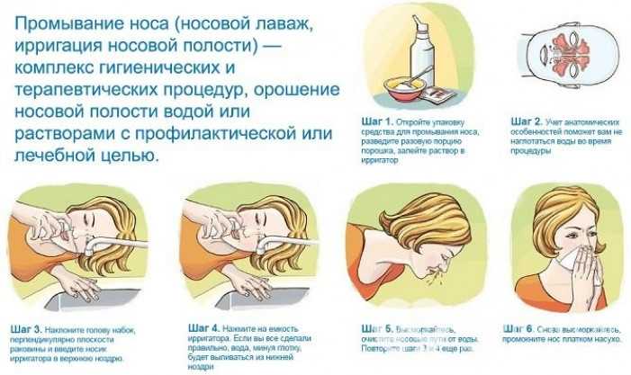 Физраствор для промывания носа: физиологический раствор в домашних условиях, рецепт промывки натрием хлорида при насморке у ребенка