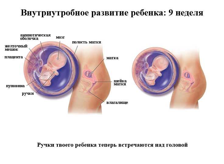 Анэмбриония: причины, симптомы, диагностика, лечение